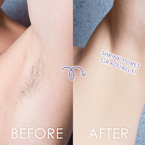 Electric Rechargeable Body Shaver For Women
