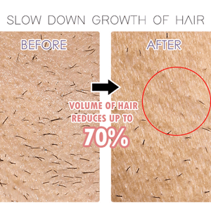Electric Rechargeable Body Shaver For Women