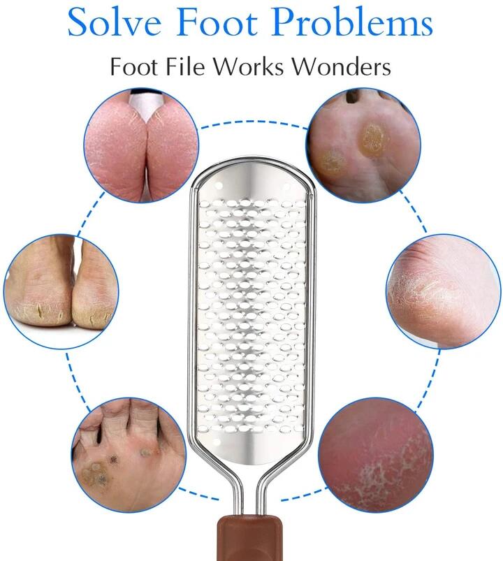 Exfoliating and removing dead skin foot file
